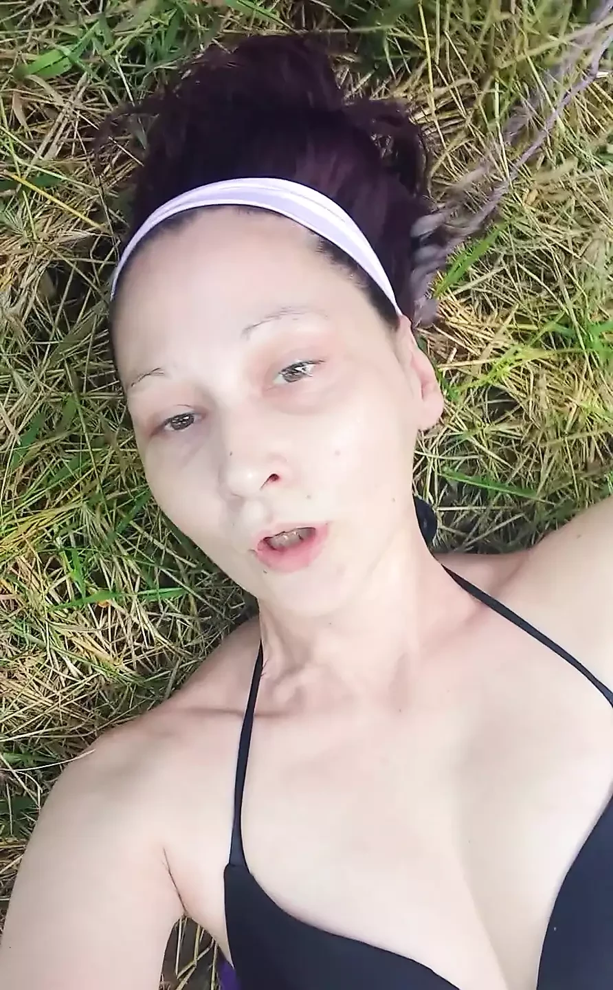 Something Bit My Ass and Tits