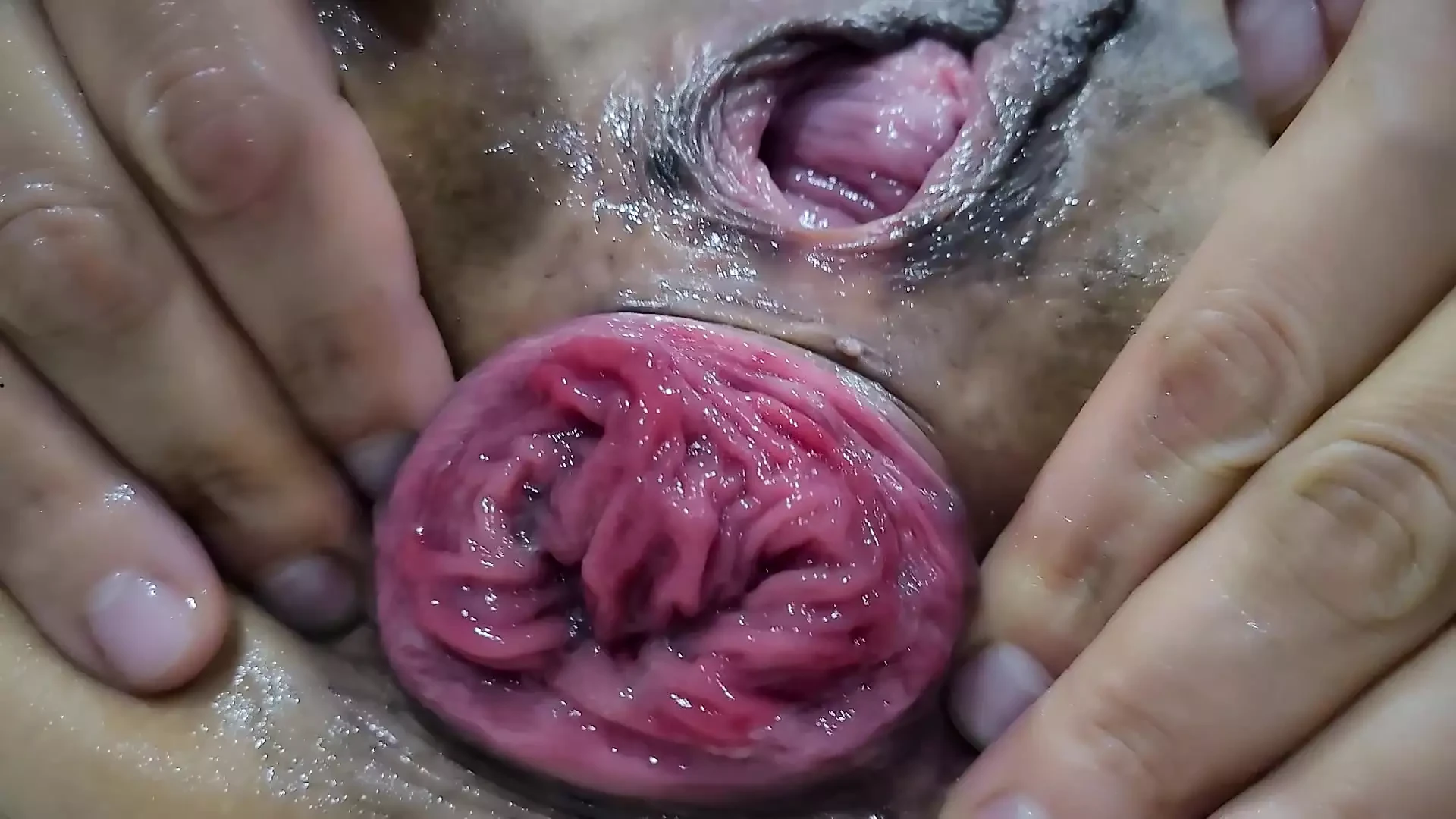 Fisting anal. Prolapse. Purchase plan.