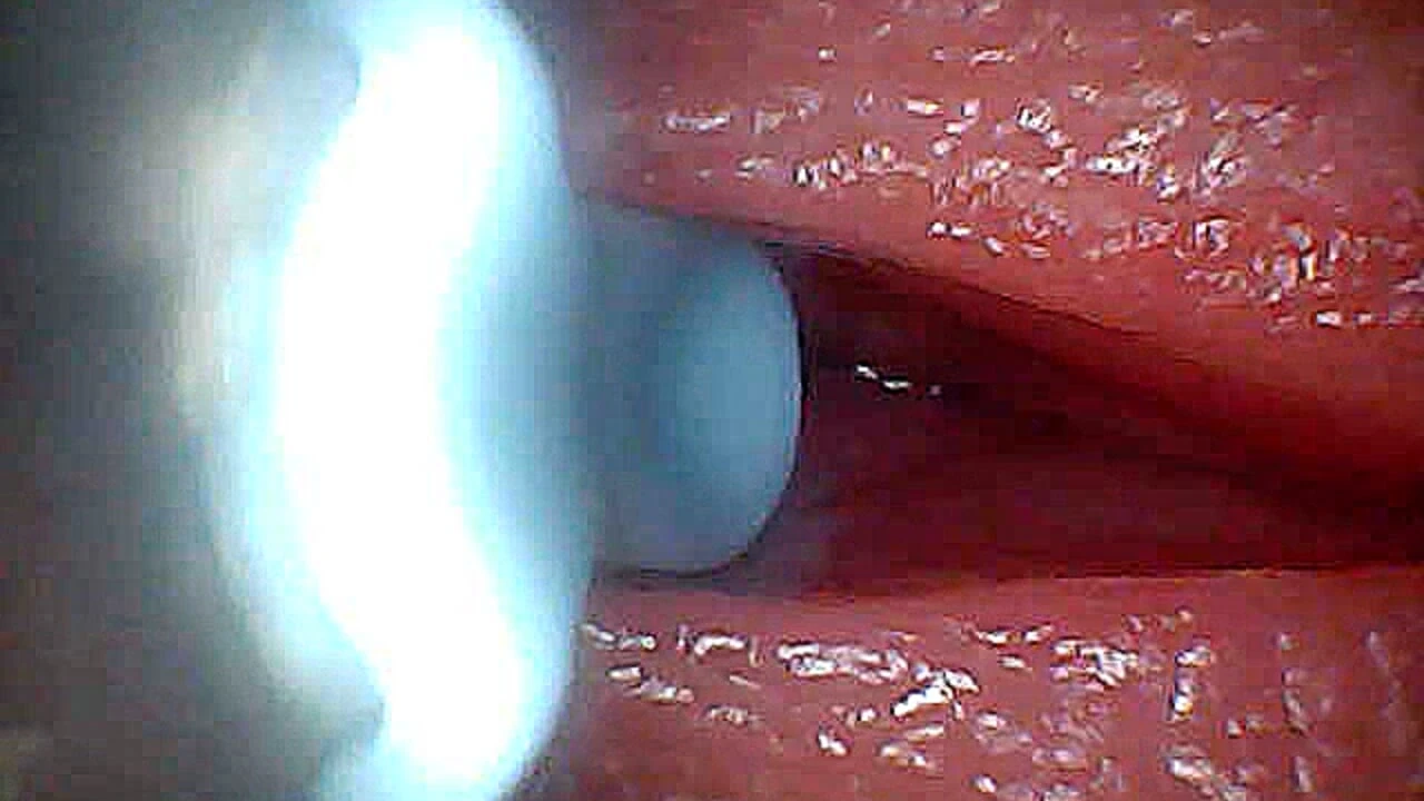 I couldn’t believe what happens INSIDE the penis as sperm passes through (endoscopic footage)